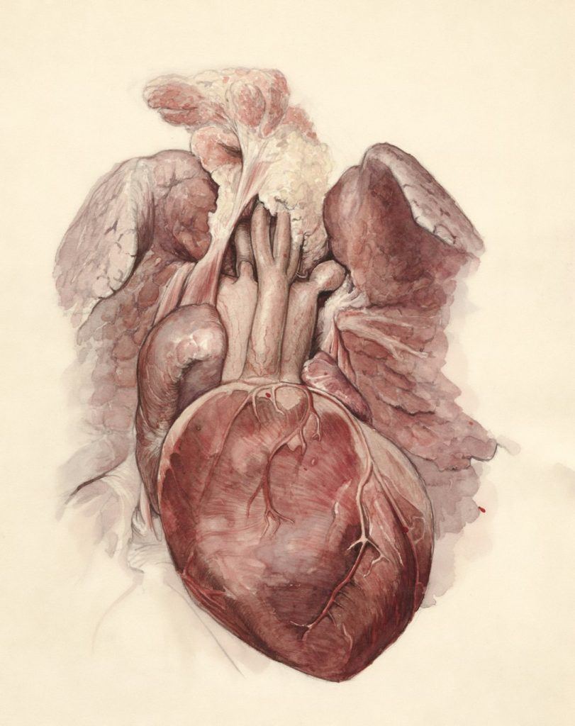 Title: Tetralogy of Fallot (heart) Creator: Mol. L., (draftsman) Date: 1958 Providing institution: Universitaire Bibliotheken Leiden Aggregator: Dutch Collections for Europe Providing Country: Netherlands Public Domain Tetralogy of Fallot (heart) by Mol. L., (draftsman) - 1958 - Leiden University Libraries, Netherlands - Public Domain. https://www.europeana.eu/item/744/item_3203373